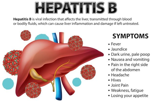 Hepatitis b symptoms