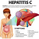 hepatitis c